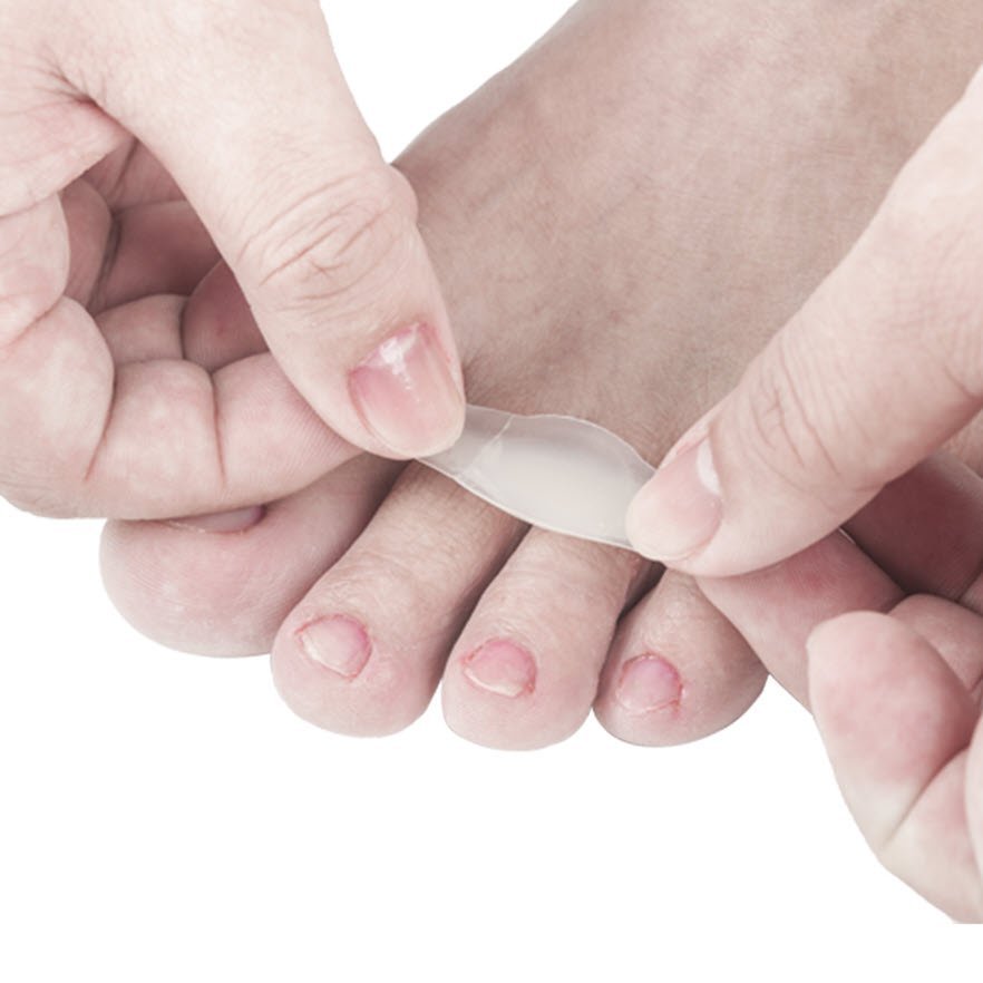 Hydrocolloid Dressing For Blisters